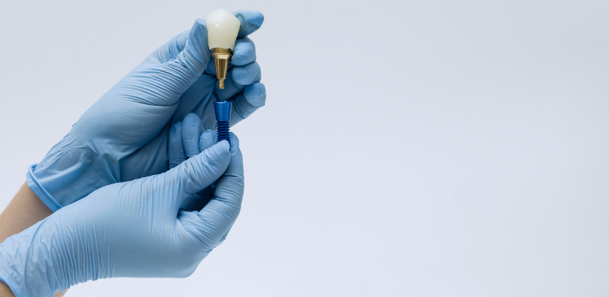 Eksik diş için implant tedavisi uygulaması