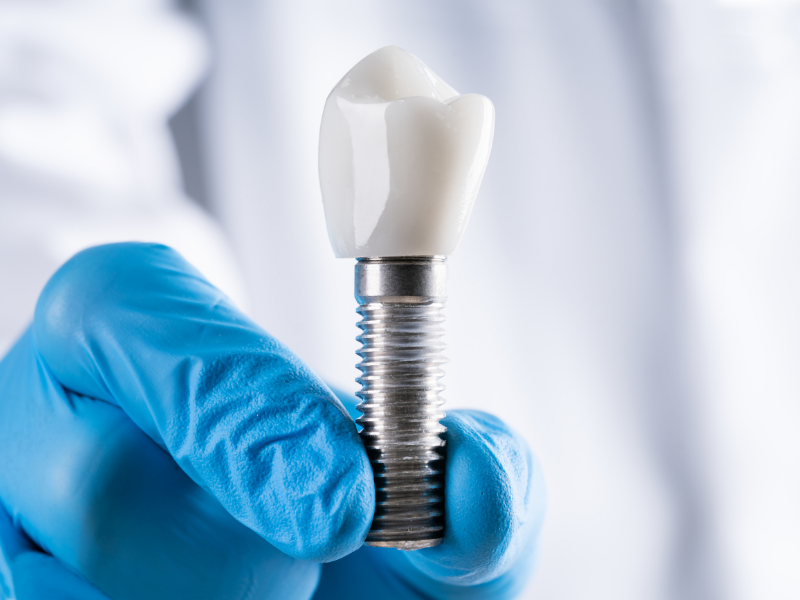 Eksik diş için implant tedavisi uygulaması